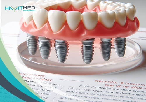 Dental implant Istanbul price istanbul dental implant