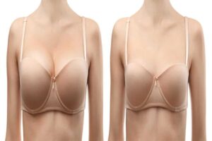 Breast reduction surgery recovery