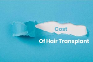 Cost of a Hair Transplant