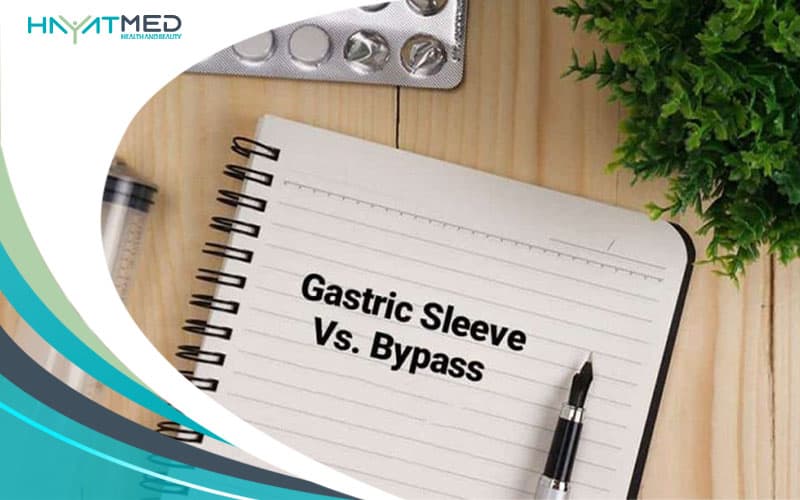 Gastric Sleeve Vs. Bypass new