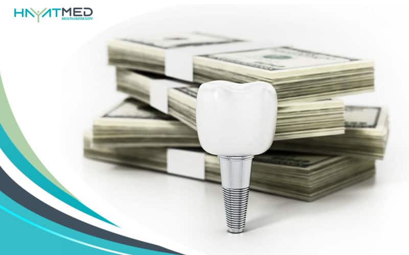 Cost Of Dental Implants new