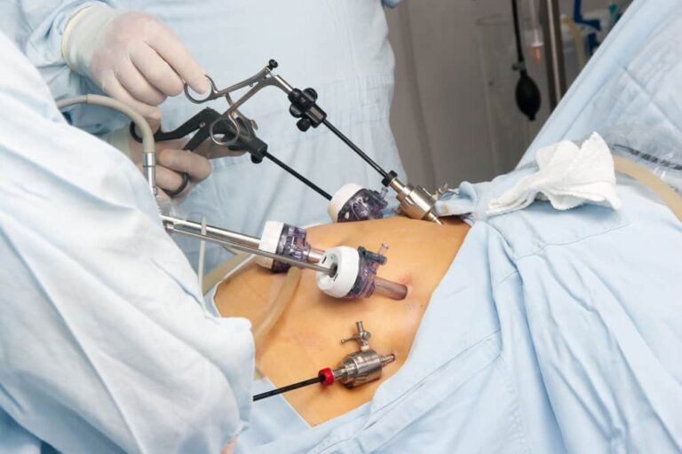 Gastric Bypass Surgery Cost in Turkey