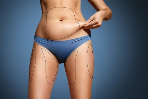 Benefits of fat removal surgery