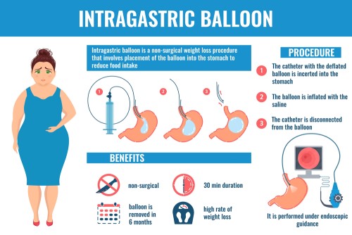 How is Gastric Balloon in Turkey performed