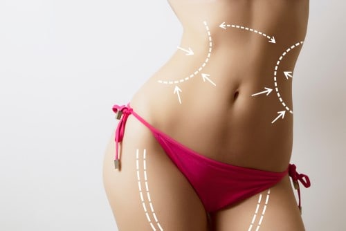 Targeted areas for VASER liposuction