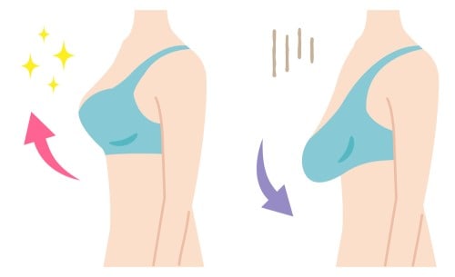 What causes sagging breasts