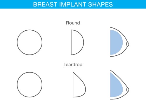 Which Type of Breast Implant Feels the Most Natural