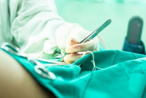 vaginoplasty procedure