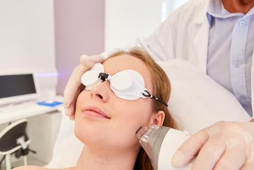 How do you prepare for the Fractional Laser treatment