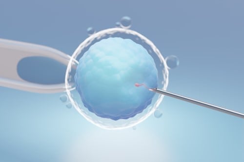 Intracytoplasmic Sperm Injection procedure done