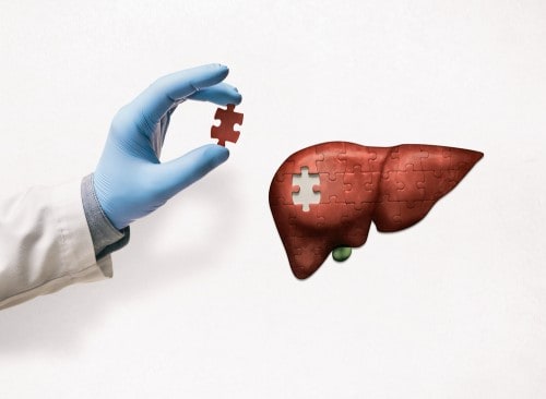 liver transplant cost