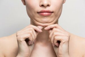 Liposuction on chin cost