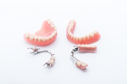 Dental implants vs. dentures