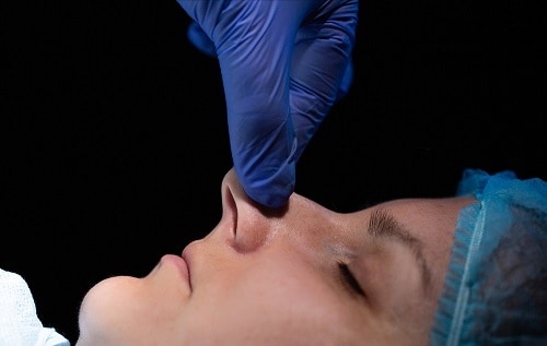 Reshaping Nasal Tip