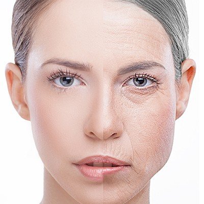 Different-Types-of-Facelift-Surgery