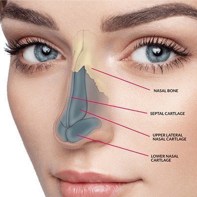 Medical Reasons for a Nose Job