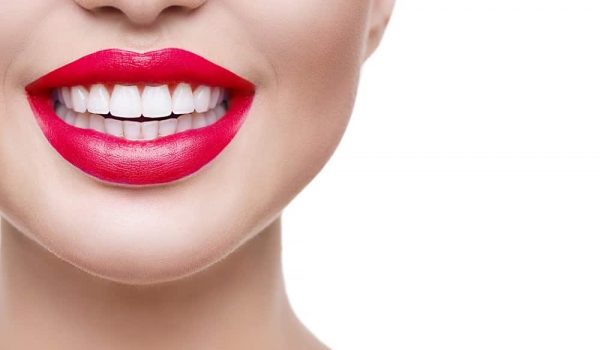 Are Veneers Permanent - The Complete Guide