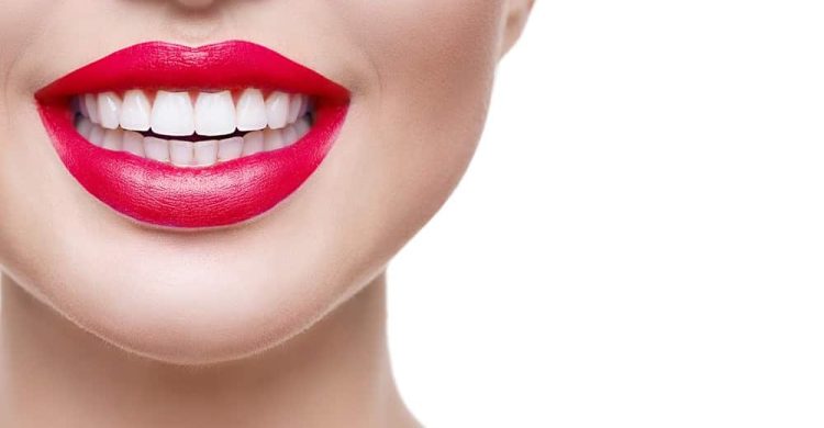 Are Veneers Permanent - The Complete Guide