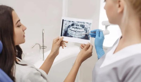Cost for dental implants full mouth