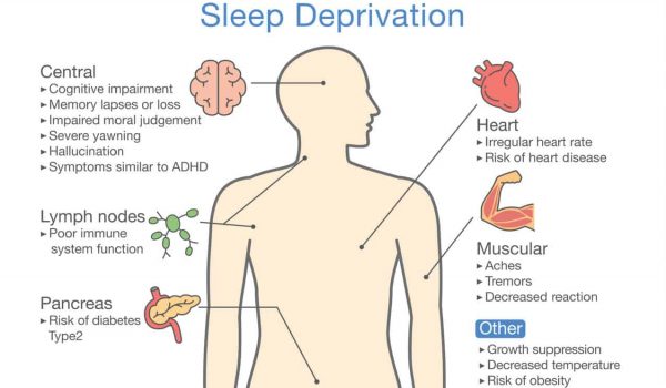 Effects Of Sleep Deficiency
