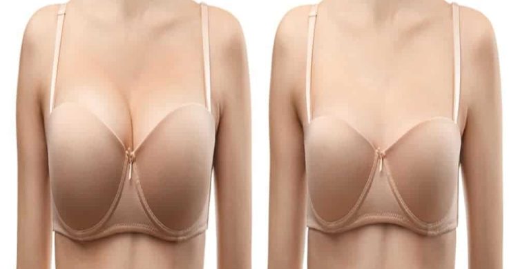 Breast reduction surgery recovery