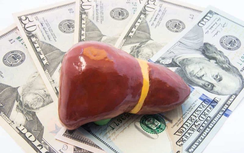 What is the cost of a liver transplant?