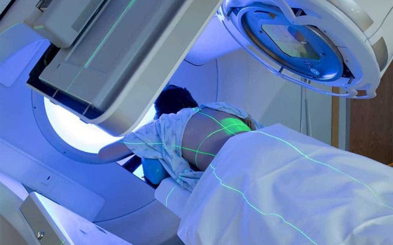 What is radiation therapy and its Uses in the Medical World Today