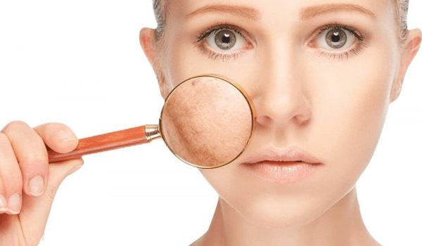 What Is Skin Pigmentation?